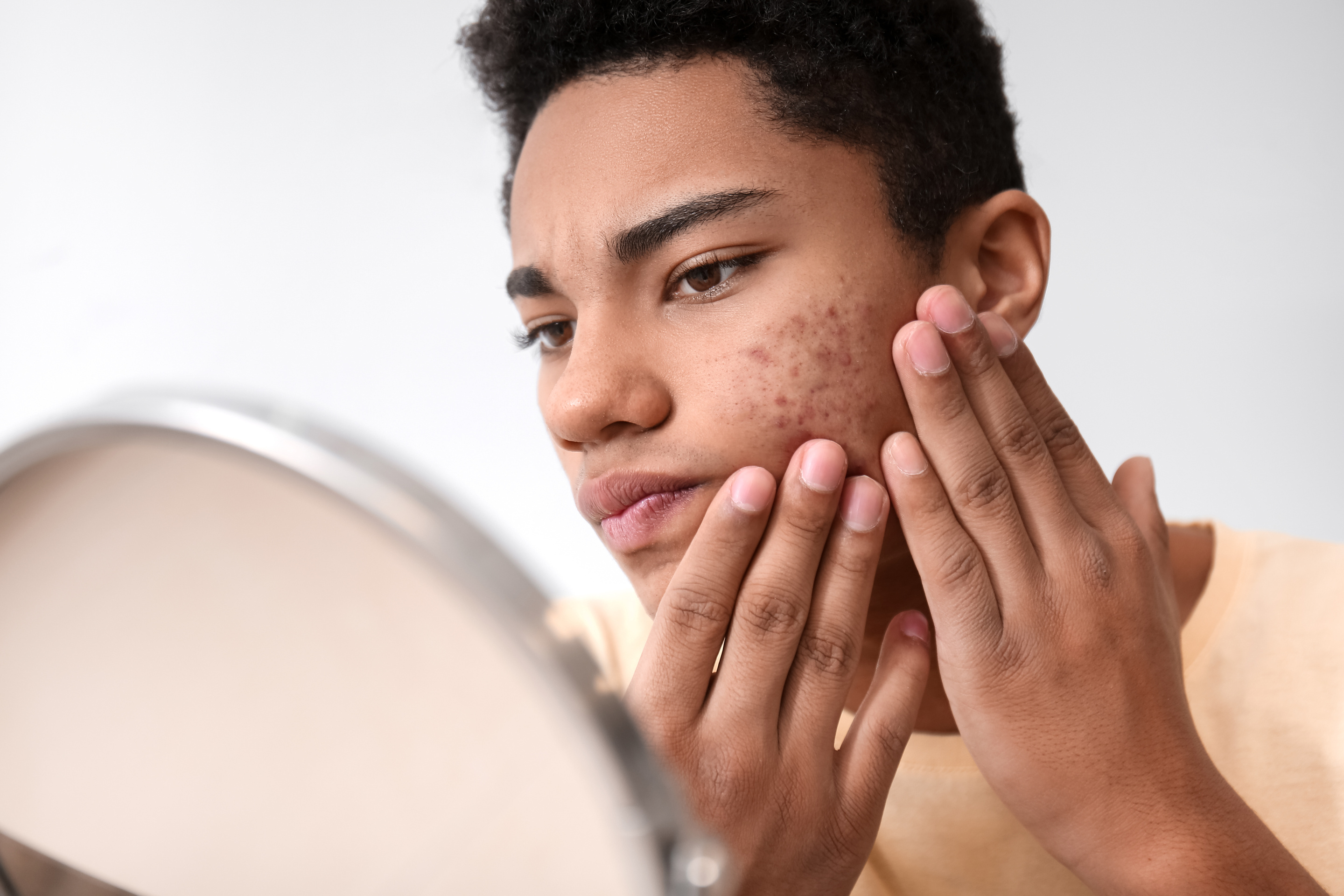 African-American Teenage Boy with Acne Problem at Home